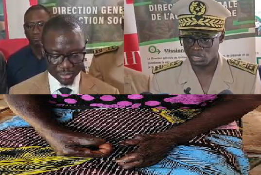 Touba mobilisée contre la lèpre : des cas récents relancent l’alerte sanitaire