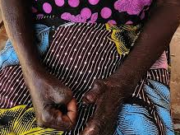 Touba mobilisée contre la lèpre : des cas récents relancent l’alerte sanitaire